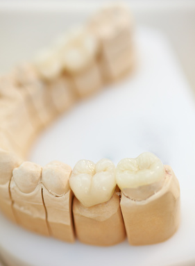 虫歯、歯周病のメインテナンスから患者様の生涯のサポートを目指して