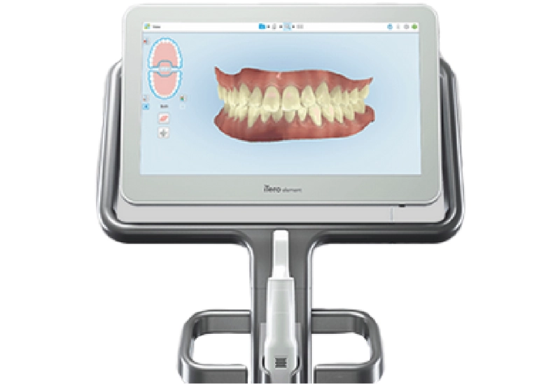 iTero 口腔内スキャナー