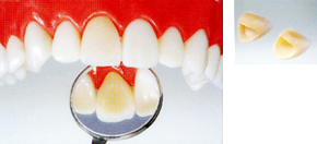 ハイブリッドセラミックス