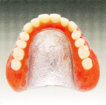 コバルトクローム合金＋プラスチック