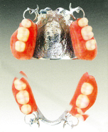 コバルトクローム合金＋プラスチック