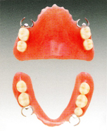 保険適用プラスチック