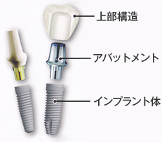 虫歯、歯周病のメインテナンスから患者様の生涯のサポートを目指して