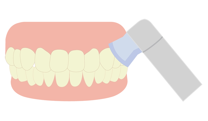 歯の表面をクリーニング